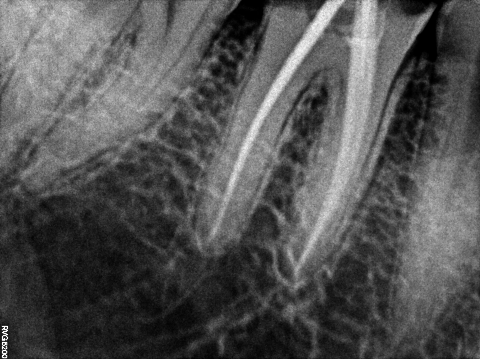 Dental X-ray